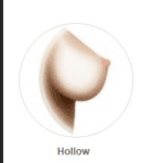 Hollow Breasts
