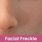 Add Facial Freckle +$29.0