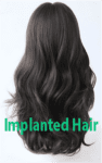 Implanted Hair #1 +$299.0