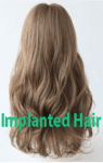 Implanted Hair #2 +$299.0