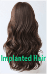 Implanted Hair #3 +$299.0