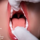 Add Realistic Oral Structure