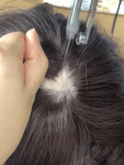 Implanted Hair +$199.0